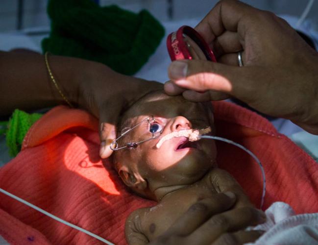 Best retina specialist in Indore