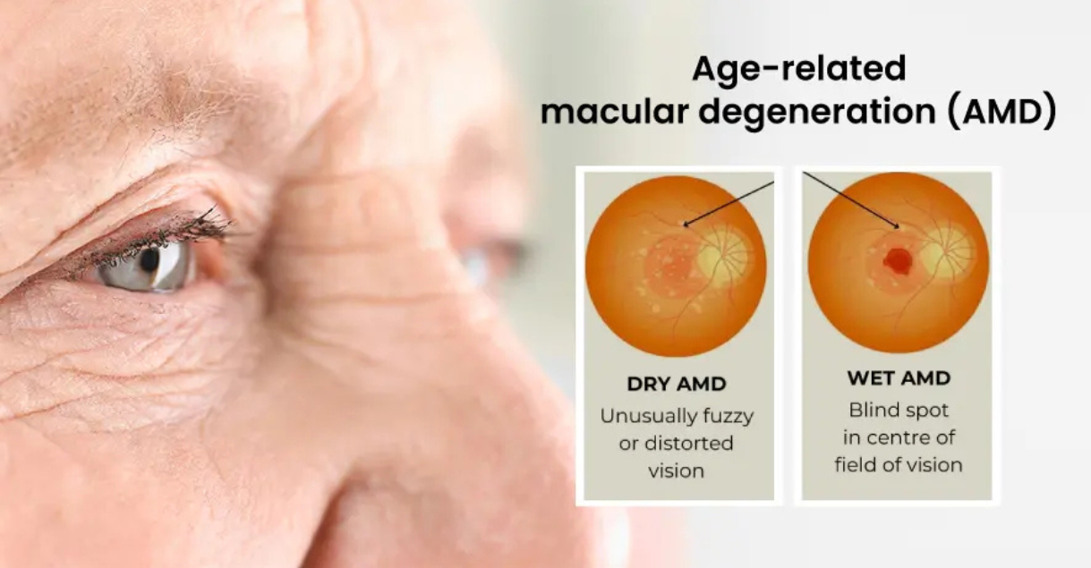 Best retina specialist in Indore